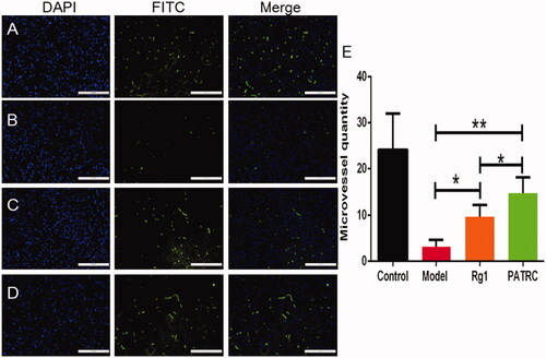 Figure 6. The capillary of infarction tissue detected with immunofluorescence. Identified ischemic tissues were harvested; formalin fixed; paraffin embedded and cut into 5 μm for CD31 immunofluorescence. (A) Control group; (B) model group; (C) cerebral infarction model group treated with Rg1; (D) cerebral infarction model group treated with PATRC; (E) microvessels quantity in cerebral infarction area of different groups. Scale bar was 100 μm. *p < .05, **p < .01.