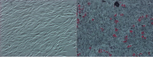 Figure 1 (A) MSCs (P2) derived from bone marrow of acute lymphoblastic leukemia. (B) Adipogenic differentiation of MSCs (P2) derived from bone marrow of acute lymphoblastic leukemia (oil red O staining) (MSCc and adipogenic differentiation are shown in 10× magnification).
