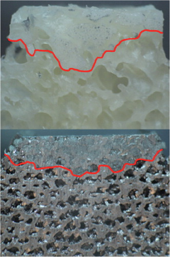 Figure 6. Representative example of cement penetration into the cancellous bone (above) and porous metal (below).