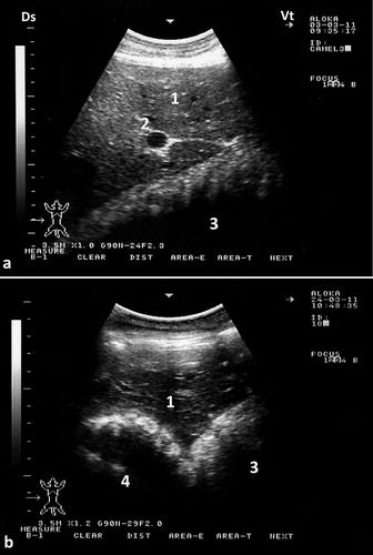 Figure 7. Ultrasonograms of the omasum and abomasum in a healthy camel. Image (a) shows the omasum and image (b) shows the abomasum at the level of the right 6th and 9th intercostal spaces, respectively. The omasal folds in image (a) appeared as fine and smooth moderately echogenic bands, while the abomasal folds in image (b) appeared as coarse and thick highly echogenic bands. 1 = liver; 2 = portal vein; 3 = omasum; 4 = abomasum. Ds = dorsal; Vt = ventral.