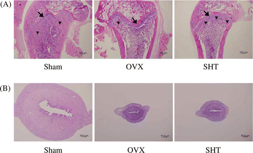 Figure 3.  Histomorphological analysis of (A) femur (× 20) and (B) uterus (× 40). After SHT administration (0.6 g/kg BID) for 12 weeks, the femur and uterus of each animal were fixed and stained with H&E as described in Materials and methods. Representative photomicrographs from the sham, OVX and SHT groups. Arrow, growth plate; arrow head, trabeculae.