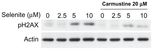 Figure 7 Absence of genotoxicity in normal prostate epithelial cells treated with a combination of nontoxic doses of selenite and carmustine. PZ-HPV-7 cells were pretreated with 20 μM carmustine for 30 minutes and then treated with the indicated concentrations of selenite (2.5–10 μM) for 24 hours. The expression of phospho-H2AX protein, a marker of DNA double-strand breaks, was then determined by Western blot analysis as described in the Materials and methods section. The blots shown are representative of three separate experiments. β-actin was used as a loading control.