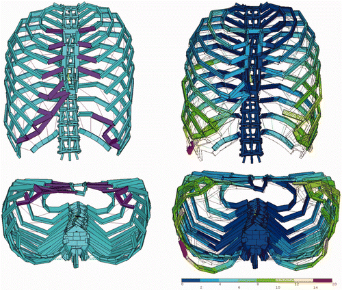 Figure 5. An example of thoracic transformation presented by a Type I-b model. The left and right figures indicate thorax shapes before (left) and after (right) inspiration. The dotted lines in the figures at right indicate the thorax shape before inspiration. The contours indicate the degree of deviation in millimeters.