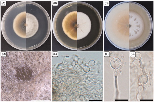 Figure 5. Cultural and morphological characteristics of NC13-171. (A) Colony on potato dextrose agar; (B) Malt extract agar; (C) Oatmeal agar at 25 °C in 14 days, reverse and obverse side view, respectively. (D) Structures formed in culture; (E–G) Chlamydospores. Scale bars: D = 500 μm; E–G = 10 μm.