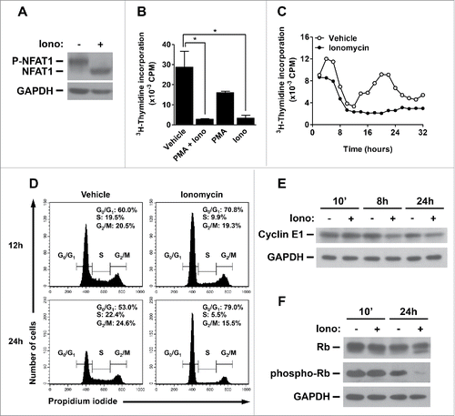 Figure 5. NFAT1 induces cell cycle arrest and inhibits Cyclin E expression in B cell lymphoma. (A) Total protein lysates were obtained from Raji cells stimulated or not with Ionomycin (5 μM) in the presence of 2 mM of CaCl2 for 10 minutes. NFAT1 and GAPDH protein levels were detected by protein gel blot. (B) Raji cells were stimulated or not with PMA (10 nM) and/or Ionomycin (5 μM) for 24 hours. (C) Raji cells were stimulated or not with Ionomycin (5 μM) for 32 hours and analyzed every 2 hours. (B and C) After stimulation, cells were pulsed with 3H-thymidine (5 μCi/mL) for 2 hours. Cells were then harvested and 3H-thymidine incorporation was analyzed by β-spectrometer. CPM refers to counts per minute. (D) Raji cells were stimulated or not with Ionomycin (5 μM) for the indicated time points. Cells were then labeled with propidium iodide, and DNA content was analyzed by flow cytometry for cell cycle phases. (E and F) Total protein lysates were obtained from Raji cells stimulated or not with Ionomycin (5 μM) for the indicated time points. Cyclin E1, Rb, phospho-Rb (Thr821 and Thr826), and GAPDH protein levels were detected by western blot. All results are representative of at least 3 independent experiments. Results are expressed as mean and error bars represent SD. Asterisks indicate significance levels compared to controls (p < 0.05).