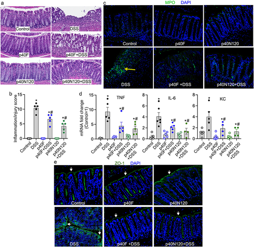 Figure 6. Neonatal p40N120 supplementation prevents colitis in adult mice. Wild-type C57BL/6J mice were treated with p40F or p40N120 from postnatal day 2 to day 21. Colitis was induced by 3% DSS in drinking water for 4 days in mice at the age of 8 weeks. Mice receiving water were used as controls for DSS treatment. (a) colon sections were stained with hematoxylin and eosin for assessment of inflammation. (b) the inflammation/injury scores are shown. (c, e) MPO expression (yellow arrows) and ZO-1 localization (white arrows) in colonic sections were evaluated by immunohistochemistry using anti-MPO and anti-ZO-1 antibodies, respectively, followed by a FITC-labelled secondary antibody (green). Nuclei were stained with DAPI (blue). (d) RNA was isolated from the colonic tissues for RT-PCR analysis of the indicated proinflammatory cytokine mRNA levels. The average of mRNA expression levels in the control mice was set as 100%, and the mRNA expression level of each mouse was compared to this average. *p < .05 compared to the control mice. #p < .05 compared to the DSS control group. Each symbol in B and C represents data from one mouse. In D and E, images represent data from 5 mice in each group.