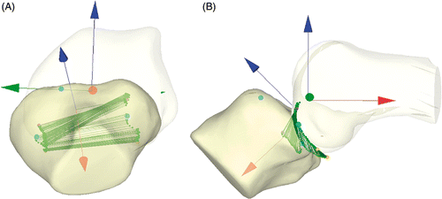 Figure 3. During kinematic replay, the tibiofemoral translation path is represented by yellow dots connected by green lines. This visual representation aids the examiner in tracking the motion of the tibia over the femur during each test. The bones may be rotated through 360° to allow visualization from any angle (A, B).