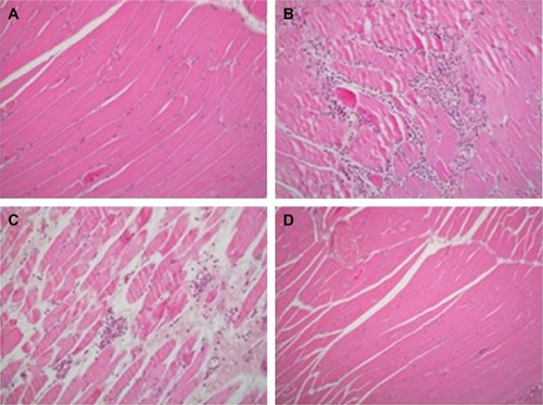 Figure 2 Lung parenchyma of four groups.