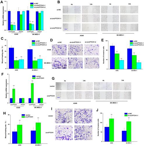 Figure 2 circPTCH1 regulates lung cancer cells migration, invasion. (A) QRT-PCR assay showed si-circPTCH1 could significantly decreased the expression of circPTCH1 and not significantly effect mRNA PTCH1 level in A549 and SK-MES-1 cells. (B, C) Wound healing assays showed that circPTCH1 knockdown significantly suppressed migration A549 and SK-MES-1 cells. (D, E) transwell assays showed that circPTCH1 knockdown significantly suppressed migration A549 and SK-MES-1 cells. (F) RT-PCR assay showed overexpression circPTCH1 plasmid could significantly decreased the expression of circPTCH1 and not significantly effect mRNA PTCH1 level in A549 and SK-MES-1 cells. (G–J) Cell migration and invasion abilities of A549 and SK-MES-1 transfected with circPTCH1 or vector were assessed by Wound healing and transwell assays. Data represent mean ± SD. **P < 0.01 compare with negative control.