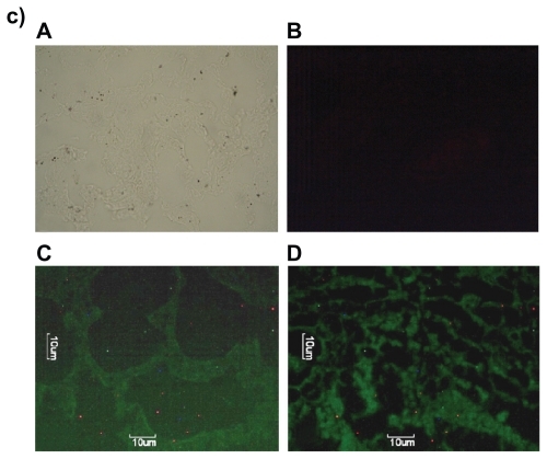 Figure 7 Fluorescence microscopic photographs of a) liver; b) kidneys; and c) lungs of rats treated with fluorescein isothiocyanate-phosphatidylethanolamine-doxorubicin (FITC-PE-DOX) liposomes (A = negative control; B = positive control; C = one hour after treatment; D = three hours after treatment).