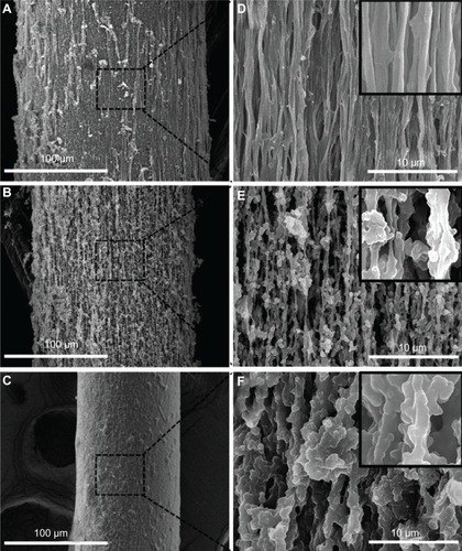 Figure 5 SEM images of Fbg microfibers fabricated from three different concentrations of Fbg.Notes: Decreasing fiber diameter was observed with decreasing Fbg concentration. Images (A–C) show 200 μm, 150 μm, and 75 μm fibers, respectively, which were made from 15, 10, and 5 wt% Fbg, respectively. Images (D–F) represent highly aligned nanostructures, highly interporous fibers with aggregated structures, and less porous fibers with unaligned structure, respectively, and are the same as the lower magnification images in (A–C), respectively (inlet images scale bar is 1 μm). Copyright © 2012, Dove Medical Press Ltd. Reproduced with permission from Rajangam T, An SS. Improved fibronectin-immobilized fibrinogen microthreads for the attachment and proliferation of fibroblasts. Int J Nanomedicine. 2013;8:1037–1049.Citation51Abbreviations: Fbg, fibrinogen; SEM, scanning electron microscope.