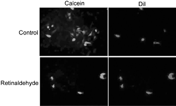 2 Inhibition of dye transfer by retinaldehyde as measured by the preloading method. Liver epithelial cells preloaded with DiI and calcein AM were mixed with unlabeled cells and plated in the absence or presence of 10 μM retinaldehyde. Dye transfer was measured 90 min later in the monolayers formed. (See Color Plate VI).