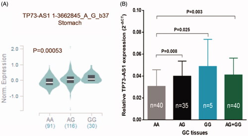Figure 2. The effect of rs3737589 on TP73-AS1 expression level. (A): The genotype of rs3737589 and expression of TP73-AS1 gene in stomach was based on the public GTEx portal database. (B): TP73-AS1 levels were determined by qRT-PCR in GC tissues in subjects with the AA (n = 40), AG (n = 35) or GG (n = 5) genotype of rs3737589. Results were shown as mean ± standard error relative to GAPDH levels.