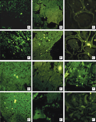 Figure 3.  Fluorescent uptake after 1 h administration of 6-CF bearing uncoupled liposomes (alphabetical) and T-DSPE coupled liposomes (alphabetical artistic) in various androgen target organs. (A) Liver, (B) Prostate, (C) Testis, (D) Brain, (E) Spleen, (F) Kidney. The photographs clearly reveal that after administration of T-DSPE coupled liposomes the fluorescence of testosterone targeted organs is higher as compared to uncoupled liposomes, i.e. liver, prostate, testis, and brain, while non-target organs, i.e. spleen and kidney, show lesser fluorescence after administration of T-DSPE liposomes. It is clear that T-DSPE liposomes have better selectivity towards ARs targeted organs.