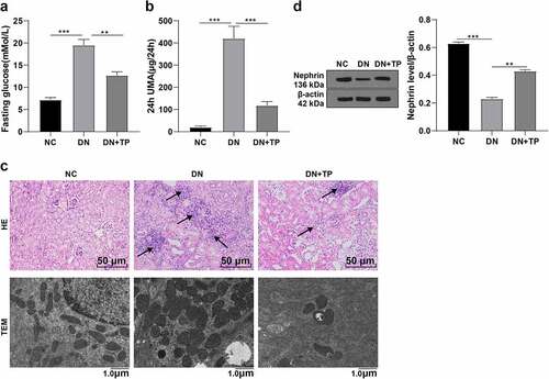 Figure 1. TP ameliorated DN and reduced podocyte injury in mice. The DN mouse model was induced by HFD feeding combined with injection of STZ in vivo, and treated with TP for 12 weeks. A: fasting glucose value of mice detected using kits B: 24 h UMA in mice; C: HE staining was used to observe the pathological changes of renal tissues and transmission electron microscopy was used to observe the ultrastructural changes of the podocyte in the renal cortex; D: WB was used to detect the level of Nephrin, a marker in renal podococytes of mice; Measurement data were expressed as mean ± standard deviation, N = 10, Kruskal–Wallis univariate ANOVA (k samples) test was used for data comparison among multiple groups. P value was obtained from a bilateral test, ** P < 0.01, *** P < 0.001.