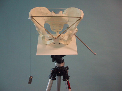 Figure 1. Sawbone pelvis model: Attached plumb line, pelvis frontal plane, and acetabular cup with rod indicating its inclination and anteversion angles.