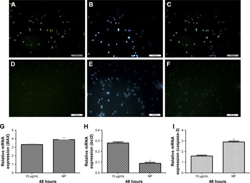 Figure 3 TUNEL assay for EL4 cells treated with free cisplatin and 2 mg/mL of CDDP/PLGA NPs and comparison of the mRNA levels of apoptosis-related genes in the EL4 cells treated with cisplatin (10 μg/mL) and 2 mg/mL of cisplatin-loaded PLGA NPs for 48 hours.Notes: The green cells indicate the TUNEL-positive apoptotic cells. It can be seen that the number of apoptotic cells increased after 48 hours in the group treated with 2 mg/mL CDDP/PLGA NPs: (A) TUNEL assay; (B) DAPI staining; and (C) merged. Comparison with free cisplatin: (D) TUNEL assay; (E) DAPI staining; and (F) merged. Activated gene expression of (G) Bax and (I) caspase-3. (H) Downregulation of antiapoptotic gene, bcl2. Each value represents mean ± SD, and the experiments were carried out in triplicate. *p ≤ 0.05 as compared with EL4 cells that were treated with 2 mg/mL of cisplatin-loaded PLGA NPs. Bar = 100 μm.Abbreviations: CDDP, cis-diaminedichloroplatinum; PLGA, poly(lactic-co-glycolic acid); NPs, nanoparticles.