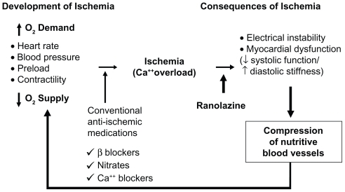 Figure 3 Sites of action of anti-ischemia medication. Reprinted from Stone P. Ranolazine: new paradigm for management of myocardial ischemia, myocardial dysfunction, and arrhythmias. Cardiol Clin. 2008;26:603–614.Citation58 Copyright © 2008, with permission from Elsevier.