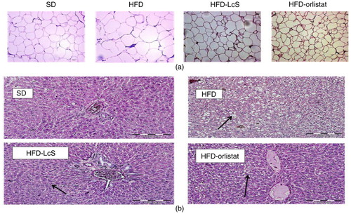 Fig. 2 Histological analysis. a) Adipose tissue, b) liver tissue. SD: standard diet; HFD: high-fat diet; HFD-LcS: high-fat diet supplemented with LcS; HFD-orlistat: high-fat diet treated with orlistat. Size of adipocytes in SD group=59.8 µm, HFD group=374.8 µm, HFD-LcS group=156.5 µm, HFD-orlistat group=192.2 µm. Black arrows in liver tissue show the fat visuals.