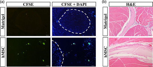 Figure 3. Detection of transplanted hMSCs in the tissue. (a) Immunofluorescence analysis using CFSE and DAPI was performed to detect the residual hMSCs in the perineural region of the mouse thigh after 7 days. Dotted line indicates the sciatic nerve. (b) H&E staining was performed to detect damage in the transplanted tissues (100×).
