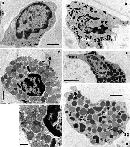 Figure 4. Transmission electron microscopy of Procambarus clarkii haemocytes 20 days after irradiation at a dose of 40 Gy. (a) Hyaline haemocytes: HH, Hyaline haemocyte. (b) Semigranular haemocytes: SH, Semigranular haemocyte. (c) Granular haemocytes: GH, Granular haemocyte. (d,e) Medium granule haemocytes: MH. (f) Detail of structured granules in MH, Medium granule haemocyte. (g) GH-like granules, sg: structured granules. Scale bars: f = 1 µm; a, b, d, e = 2 µm; c = 5 µm.