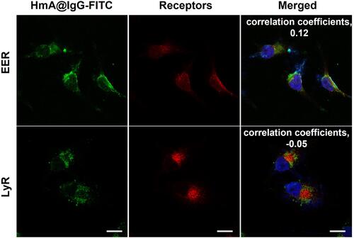 Figure 5 LSCM images of early endosome (EER)- and lysosome (LyR)-localized receptors in DC cells after treatment with different concentrations of HmA@IgG-FITC particles for 4 h; HmA@IgG-FITC particles (green); EER and LyR (red); DAPI (blue); The scale bars were 20 μm.