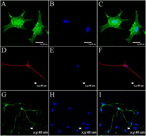 Figure 8. Neurotrophic factors promoted neuritogenesis and maturation of neurons and glia derived from NSCs after induced for 12 days in vitro. (A) and (B) GFAP expression and nuclear staining. GFAP as astrocyte maker. (C) Merger of (A) and (B). (D) MAP2, as neuronal marker. (F) Merger of (D) and (E). (G) MBP expression. MBP as oligodendrocyte maker. (I) Merger of (G) and (H). (E) and (H) Nuclear staining. Bar scales =  40 μm.