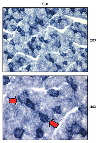 Figure 13 Visualizing mitochondrial complex II (SDH) activity in murine skeletal muscle tissue. Frozen sections of murine skeletal muscle (hind-limb/gastronemius) were subjected to SDH activity staining (blue color). Note that slow-twitch fibers (type I) are oxidative, are mitochondria-rich, and are SDH-positive (see red arrows). In contrast, fast-twitch fibers (type II) are glycolytic, are mitochondria-poor, and are SDH-negative. Two representative images are shown. Original magnification, 20x and 40x, as indicated.