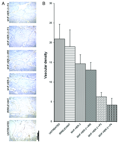 Figure 8. Combination treatment decreases microvascular density in tumors. Evaluation of vessel density in tumor sections. (A) Vascular staining using anti-CD31 antibody. (B) Effects of combination treatment on the tumor vessel density after quantification with the Image J software. Data represents mean values from four different fields and error bars represents SD of the mean.