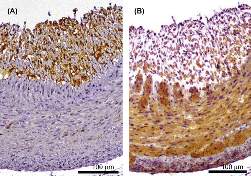 Fig. 5. Immunohistochemistry of atherosclerotic lesions in the high-fat and high-cholesterol diet (HFCD) group. The right coronary artery was analyzed via immunohistochemistry with primary antibodies against the ionized calcium-binding adaptor molecule 1 (Iba-1) and a-smooth muscle actin (α-SMA) and Envision Kit. The sections exhibit positive (A) Iba-1 and (B) α-SMA expression. All bars indicate 100 μm.