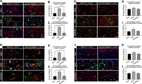 Figure 2 Localization of MALT1 and phos-NF-κB (p65) in different type of cells in the spinal cord of rats. (A) Double immunofluorescent staining showed colocalization of MALT1 or phos-NF-κB (p65) expression in astrocytes (GFAP positive cells) in the anterior horn of spinal cord. Scar bar = 20μm. (B, C) The quantified colocalization of MALT1 or phos-NF-κB (p65) with GFAP were assessed using the Pearson coefficient. (D) Double immunofluorescent staining to check colocalization of MALT1 or phos-NF-κB (p65) expression in microglia (Iba-1 positive cells) in the anterior horn of spinal cord. Scar bar = 20μm. (E, F) The quantified colocalization of MALT1 or phos-NF-κB (p65) with Iba-1 were assessed using the Pearson coefficient. (G) Double immunofluorescent staining showed MALT1 or phos-NF-κB (p65) expression in neurons (NeuN positive cells) in the anterior horn of spinal cord. Scar bar = 40μm. (H, I) The quantified colocalization of MALT1 or phos-NF-κB (p65) with NeuN were assessed using the Pearson coefficient. (J) Double immunofluorescent staining to colocalize MALT1 or phos-NF-κB (p65) with endothelial cells (CD31 positive cells) in the anterior horn of spinal cord. Scar bar = 20μm. (K, L) The quantified colocalization of MALT1 or phos-NF-κB (p65) with CD31 were assessed using the Pearson coefficient. Data are presented as the mean ± SEM. n = 6 per group. *P < 0.05 vs sham group, #P < 0.05 vs SCI/R group.