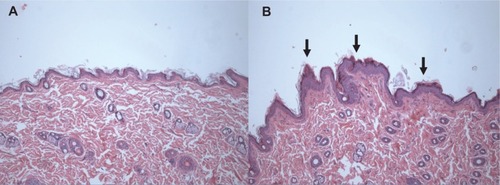 Figure 1 Histopathologic changes in the skin after treatment with zinc oxide nanoparticles at a dose of 1,000 mg/kg for 90 days. Skin sections were stained with hematoxylin and eosin (100×). (A) Control group and (B) 1,000 mg/kg treatment group.Note: Arrows in (B) represent hyperkeratosis.