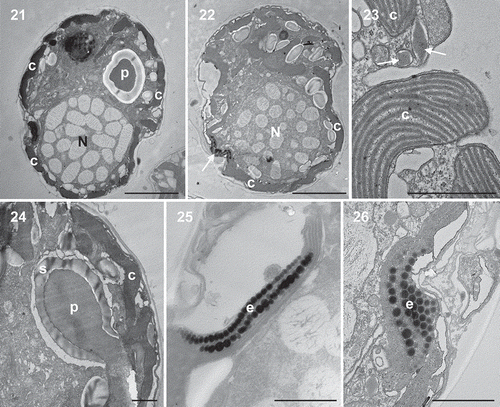 Figs 21–26. Transmission electron micrographs of vegetative cells of Caladoa arcachonensis strain TIO278 from France. Figs 21, 22. Transverse section through the cell showing a large nucleus (N), a stalked pyrenoid (p), a single chloroplast (c) in the periphery of the cell and an eyespot (arrow). Fig. 23. The chloroplast showing the thylakoids grouped in threes to form lamellae and several trichocysts (arrow). Fig. 24. Detail of the stalked pyrenoid (p) with dense matrices and surrounding starch (s). Figs 25, 26. The eyespot (e) located within a chloroplast (c) comprising several rows of globular lipids. Scale: Figs 21, 22 = 5 μm, Figs 23–26 = 1 μm.