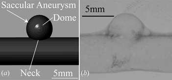 Figure 7 (a) Design of the aneurysm morphology. (b) Single layer model of saccular aneurysm built with urethane elastomer under white light source.