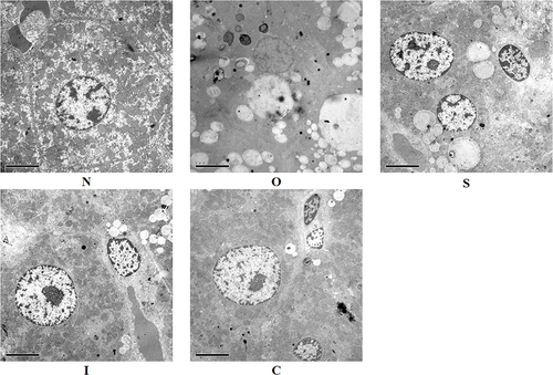 Figure 4 Electron microscopy of liver tissue. N, normal control group; O, obesity control group; S, obesity+swimming exercise group; I, obesity+intermittent fasting group; C, obesity+swimming combined with intermittent fasting group.