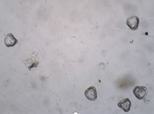 Figure 4 Moniezia eggs.