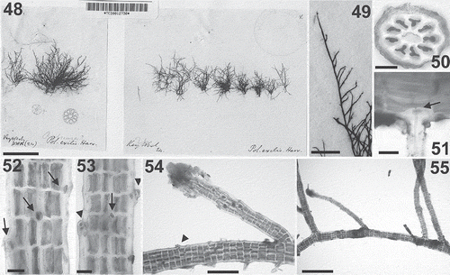 Figs 48–55. Polysiphonia exilis: type material. 48. Holotype (TCD 0012730, collected by Harvey at Key West, Florida). 49. Erect axes with secund branches. 50. Cross-section of thallus with nine pericentral cells. 51. Rhizoid cut off from a pericentral cell (arrow). 52. Detail of an erect axis with scar cells of trichoblasts on every segment (arrows) and pericentral cells in straight rows. 53. Detail of an erect axis with young cicatrigenous branches growing from scar cells (arrowheads); the arrow shows a scar cell of a trichoblast. 54. Detail of an axis bearing a branch with young tetrasporangia forming a spiral series; the arrowhead indicates a young cicatrigenous branch. 55. Detail of a prostrate axis bearing erect axes at irregular intervals. Scale bars = 2.5 cm (Fig. 48), 3 mm (Fig. 49), 50 µm (Figs 50–53), 250 µm (Fig. 54) and 650 µm (Fig. 55).