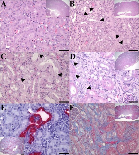 Figure 1. IBN in the kidneys of B6.Il2rRag2W mice. (A) Representative H&E section of a kidney (400×; inset 20×) from an MKPV-negative mouse. (B) Longitudinal section of kidney from case 1 with chronic IBN and mild hydronephrosis (inset 20×) and mild multifocal neutrophilic pyelonephritis. The kidney has an undulating irregular renal cortex, containing multifocal to coalescing areas of interstitial fibrosis, tubular loss, and tubular degeneration with single cell necrosis, karyomegaly, and intranuclear amphophilic to eosinophilic inclusions (arrowheads: 400×). (C) Longitudinal section of kidney from case 2 with IBN and mild neutrophilic pyelonephritis. Affected convoluted tubules in the renal cortex had vacuolated and degenerated epithelial cells with karyomegalic nuclei and large (∼5–6 µm) amphophilic intranuclear inclusions or small (∼1 µm) densely eosinophilic intranuclear inclusions (arrowheads: 400×). (D) Longitudinal section of kidney from case 3 with moderate to severe IBN (inset 20×). High magnification of the kidney from case 3 exhibited areas of interstitial fibrosis and tubular degeneration with karyomegalic nuclei, chromatin margination and intranuclear inclusions (arrowheads: 400×). (E) MKPV in situ hybridization signals (RNAscope) in renal tubules of case 3 (inset 40×). MKPV nucleic acids were detected (fast red staining) in the nucleus and cytoplasm of affected tubular epithelial cells (400×). (F) Masson trichrome staining of an affected kidney (case 1) showed marked collagen deposition (blue staining) in the renal interstitium (400×; inset 20×).