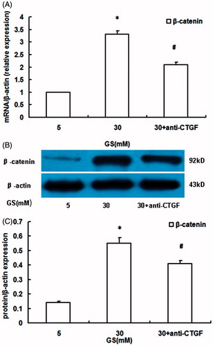Figure 4. Effects of CTGF inhibition by anti-CTGF antibody on high glucose-induced activation of nuclear β-catenin in podocytes. (A) β-catenin mRNA expression. (B and C) nuclear β-catenin protein expression. High glucose induced β-catenin overexpression in podocytes than that in normal glucose conditions, which was prevented by anti-CTGF antibody (GS, glucose; Man, mannitol; mM:mmol/L, *p < 0.05 vs. 5 mM GS, #p < 0.05 vs. 30 mM GS, n = 3).