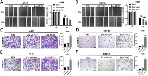 Figure 5 Exosomes from cells with high TPX2 expression promote cell invasion and migration. (A and B) The migration of A549 (A) and H1299 (B) cells after treatment with exosomes from different sources were determined by wound healing. Scale bar: 100 µm. (C and D) The migration capacity of A549 (C) and H1299 (D) cells after exosomes treatment is determined by transwell assay. Scale bar: 100 µm. (E and F) The invasive capacity of A549(E) and H1299(F) cells after treatment with exosomes is determined by transwell assay. Scale bar: 100 µm. Each bar shows the mean±SD of 3 independent experiments. Data were statistically analyzed with paired two-tailed students, t-test. *p<0.05; **p<0.01; ***p<0.001 and ****p<0.0001.