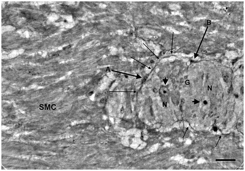 Figure 4. Colon, peripheral part of a ganglion (starting slice of Video 1).High-resolution scan. The end of the ganglion is tangentially sectioned. The short thick arrow shows a spindle-shaped cell (A) with very long projections (long thin arrows) that appear to run on the surface of the ganglion (upper right) and probably penetrate into the ganglion (lower left). A similar spindle-shaped cell (B; long, thick arrow), with part of the projections on the right, is between the ganglion and the smooth muscle cells. At the bottom of the ganglion there are thin filamentous projections (short thin arrows). Arrowheads: nuclei; G: glial cell; N: neurons; SMC: smooth muscle cells. Bar: 25 μm.