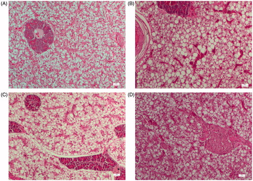 Figure 2. Liver histology of fish fed diets containing: (A) 43% protein and 15% lipid, (B) 43% protein and 20% lipid, (C) 47% protein and 15% lipid and (D) 47% protein and 20% lipid. In fish from groups fed with 20% lipid, hepatocyte lipid deposition was observed that was slightly improved as protein levels increased in the diets. Bars 100 μm, 20×.