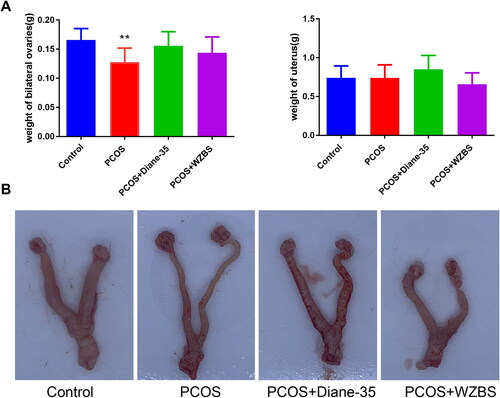 Figure 1. WZBS recipe alleviated the ovarian and uterine injuries of the LE-induced PCOS rats. (A) WZBS recipe significantly increased the weight of bilateral ovaries but had no effect on the weight of uterus in the PCOS rats. (B) WZBS recipe improved the ovarian and uterine morphology of the PCOS rats. *p < 0.05 and **p < 0.01 vs. Control. Data were presented as mean ± SD. n = 8.