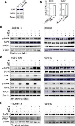 Figure 6 The combination of icotinib hydrochloride (IH) and fluzoparib (FZ) inhibited the EGFR signaling pathway and attenuated the radiation-induced upregulation of the HR protein RAD51. (A and B) Western blotting and qRT-PCR were used to detect the expression levels of EGFR and PARP1 in the HCCC-9810 and GBC-SD cell lines. (C and D) Total EGFR, p-EGFR, total AKT, p-AKT, total MAPK, p-MAPK, γ-H2AX and RAD51 were detected using Western blot assays at 2 hours (C) and 24 hours (D) after radiation. (E) Total PARP1 and cleaved PARP1 were detected using Western blot assays at 72 hours after radiation. Data are representative of at least duplicate experiments.
