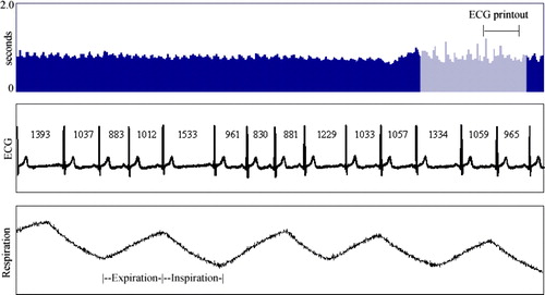 Figure 2.  Example of the nonrespiratory sudden changes in the R-R interval time series that are discarded from the respiratory sinus arrhythmia (RSA) analysis (light gray segment). At top an R-R interval tachogram, in the middle the ECG printout, and below the corresponding breathing signal.