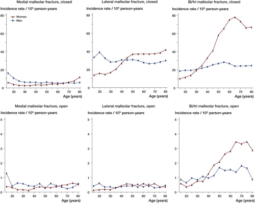 Figure 3. Incidence rates (per 105 person-years) of ankle fractures in Sweden during the period 1987–2004, stratified by age, sex, and type of fracture. Note the different scale for open fractures.