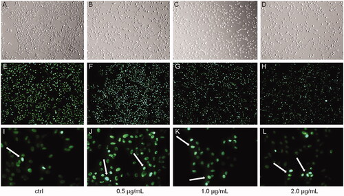 Figure 3. The nuclei of HeLa cells stained with Hoechst 33342 dye after 24 h of treatment with bersaldegenin-1,3,5-orthoacetate. (A–D) show the cells under an inverted light microscope, (E–L) – under a fluorescent microscope. The cells were treated with DMSO (0.25%) – a control sample (A, E, I) and the bersaldegenin at concentrations of 0.5 (B, F, J), 1.0 (C, G, K), and 2.0 μg/mL (D, H, L). White arrows indicate Hoechst strongly positive nuclei. The images were done at 100× (A–H) and 400× magnification (I–L), respectively.