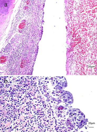 Figure 3. (a) Seven-month-old Alagoas curassow (Pauxi mitu) with tracheitis due to Aviadenovirus. The respiratory epithelium is replaced by a single layer of epithelium, with loss of goblet cells. The lamina propria is expanded by the lymphoplasmacytic infiltration. H&E. Obj. 20. Bar = 20 µm. (b) Seven-month-old Alagoas curassow (P. mitu) with tracheitis by Aviadenovirus. Lymphoplasmacytic tracheitis with epithelial necrosis, loss of goblet cells and basophilic intranuclear inclusion bodies (arrow) were detected. H&E. Obj. 40. Bar = 20 µm.