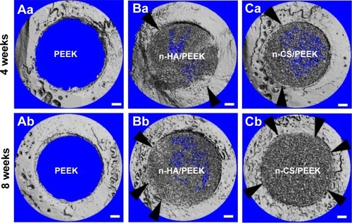 Figure 3 Representative images of the 3D reconstruction of the cranial defect in rabbits using micro-CT at 4 and 8 weeks after implantation.Notes: The black arrows indicate bone contact. The scale bar is 1 μm.Abbreviations: PEEK, polyetheretherketone; n-HA, nanohydroxyapatite; n-CS, nano-calcium silicate; 3D, three-dimensional; Micro-CT, microcomputed tomography.
