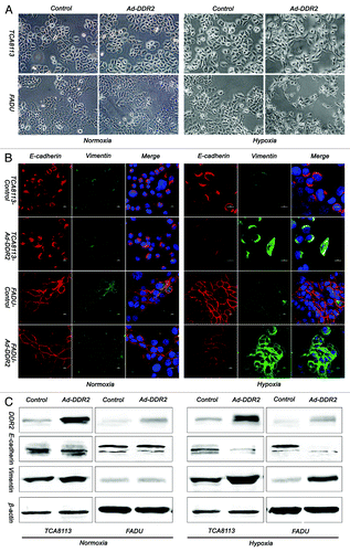 Figure 5. Overexpression of DDR2 accelerates the process of hypoxia-induced EMT in HNSCC cells. (A) Tca8113 and FaDu cells (parental and DDR2-transduced) were cultured under normoxic or hypoxic condition for 48 h, and the morphology change of cells were photographed in low-power field (200×). (B) The cells in (A) were stained for the expression of E-cadherin (red) and vimentin (green) by immunocytofluorescence. Nuclei are labeled by DAPI (blue). Scale bar 10 µm. (C) The cells in (A) were used for immunoblot analysis of E-cadherin and vimentin expression.